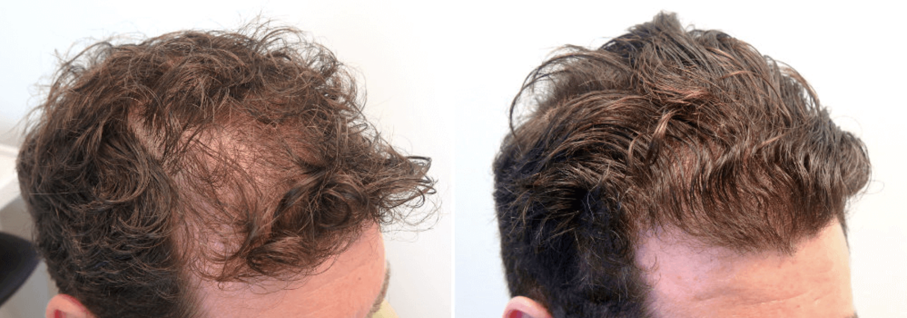 Before / After 1