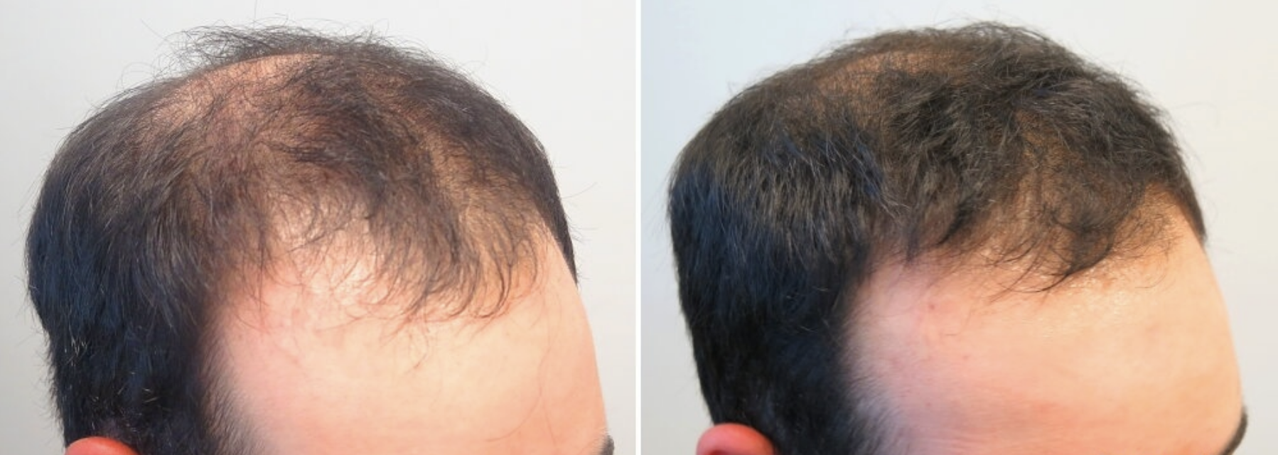 Before / After 2