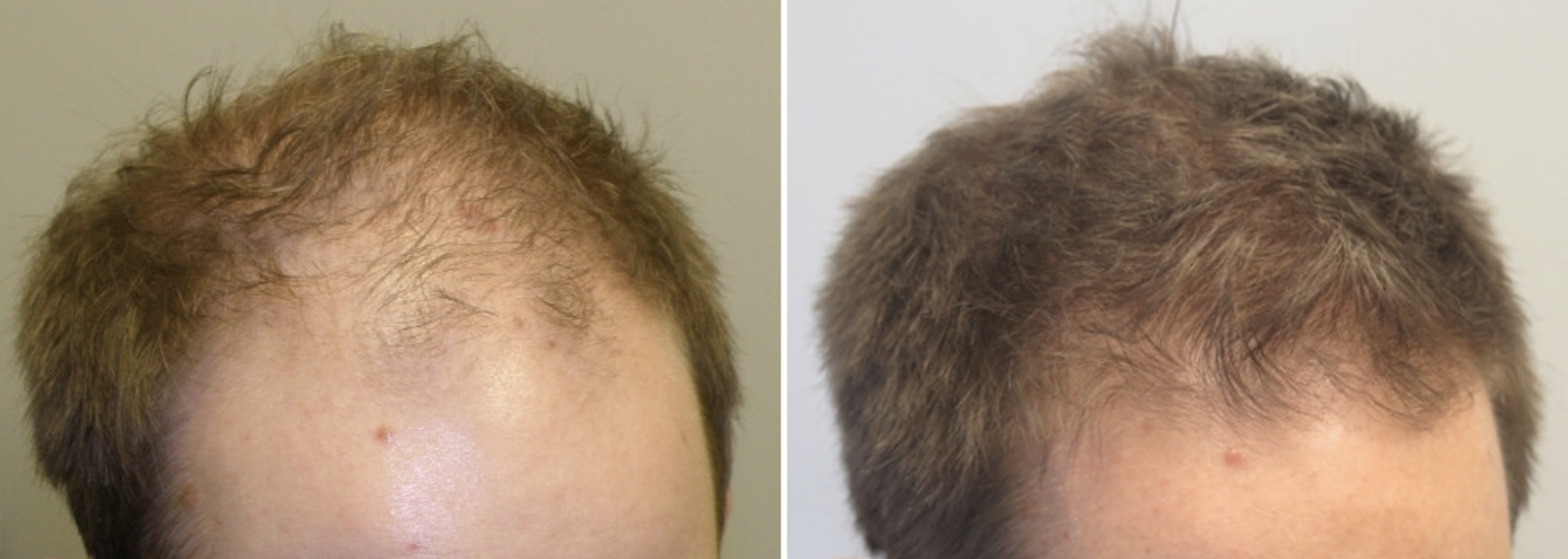 Before / After 3