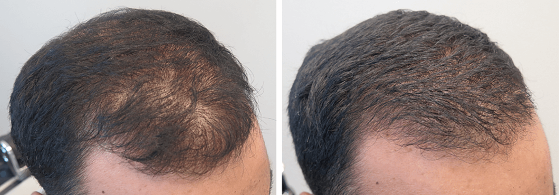 Before / After 4